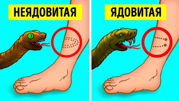 Неприятная встреча: как отличить укус ядовитой и неядовитой змеи