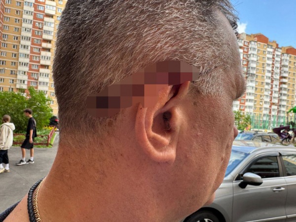 Сосед пришел резать семью с восемью детьми за небольшое затопление